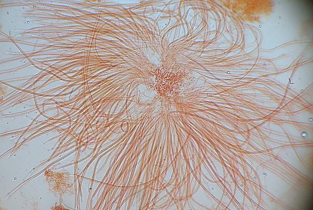 Cordyceps spec.